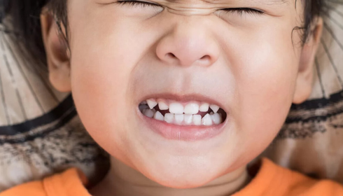 Teeth Grinding in Kids: Nighttime Clenching Signs Parents Often Miss