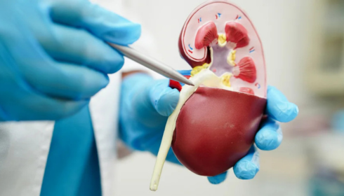 A Practical Guide to Urology and Kidney Stone Treatment in India
