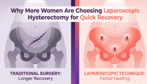 Why More Women Are Choosing Laparoscopic Hysterectomy for Quick Recovery